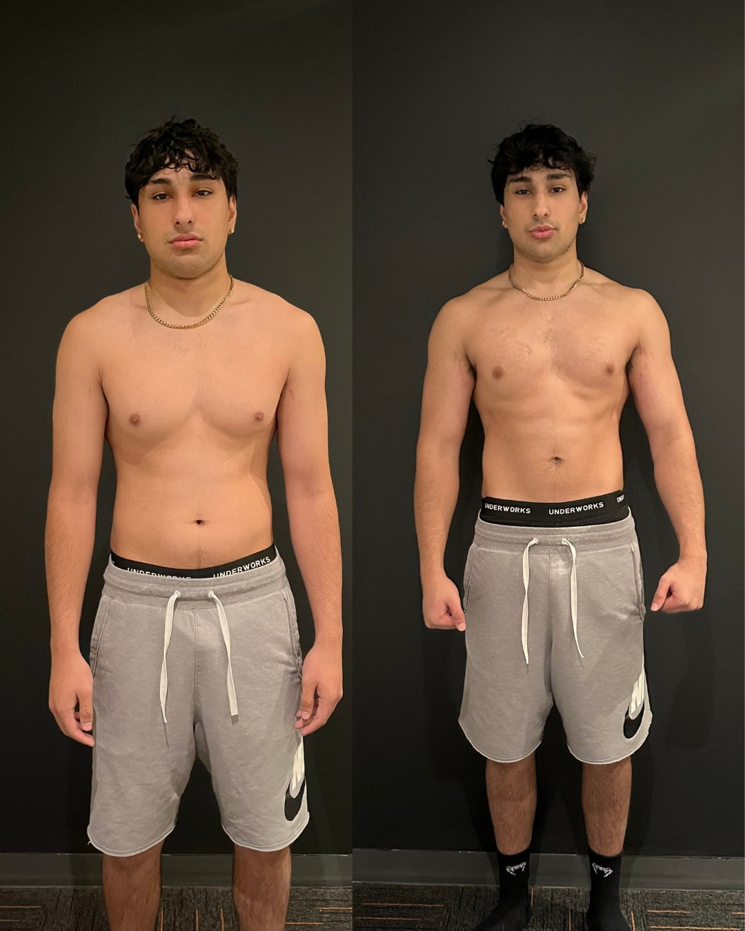 Dylan — before and after